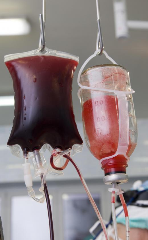 Receiving a blood transfusion may inadvertently expose an individual to HIV.