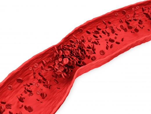 Medications that perform platelet inhibition help prevent the formation of blood clots.