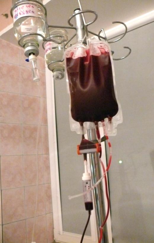 Cryoprotectants are often added to donor blood before it is frozen so that it can be properly preserved for transfusion.