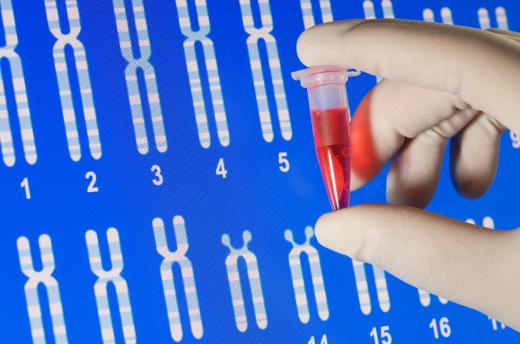 People can order genetic testing to see if there are variations in the FBN1 gene if they are concerned about passing a connective tissue disorder onto their child.