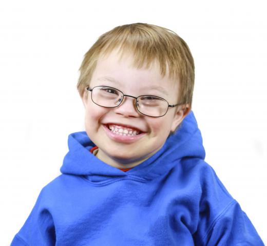 Nondisjunction can lead to genetic defects like Down's Syndrome.