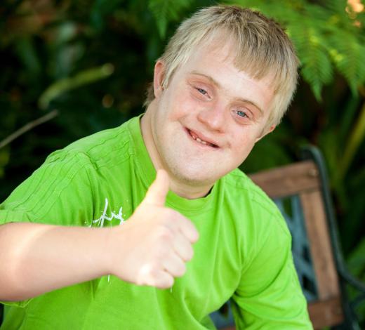 Down syndrome is caused by an autosomal trisomy of chromosome 21.