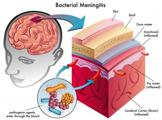 Many species of Neisseria are found in healthy human throats, but the bacteria that cause meningitis also belong to this genus.