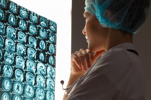 Equipment like MRI scanners help neuroscientists study the brain.