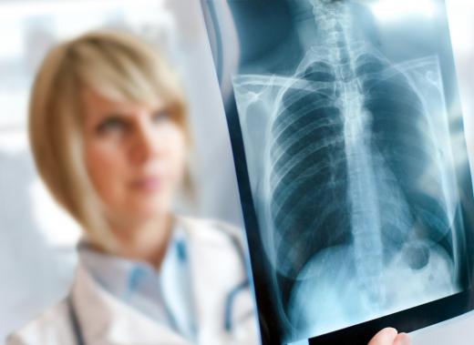 Moraxella catarrhalis bacteria can cause pneumonia, which can be diagnosed via chest X-ray.