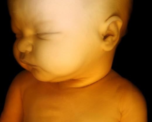 The question of whether or not a fetus is conscious is still undetermined and up for debate.