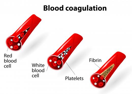 Fibrin combines with platelets and blood cells to create a clot, which seals off ruptured blood vessels.