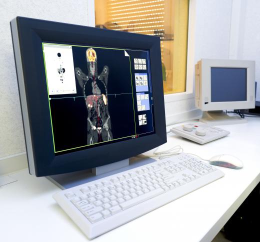 Positron emission tomography, or PET, scans use radioisotopes to trace the activity of cancer in the body.