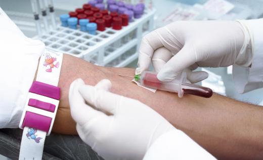 Blood samples are  analyzed to identify specific proteins and their concentrations through the ELISA method.