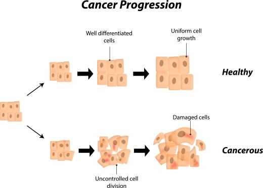 When cancers attack the body, one of the things they assault first is the extracellular matrix in the region where they grow.