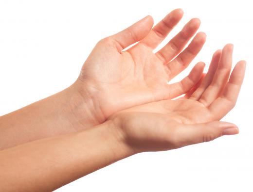 Iontophoresis is commonly used for hyperhidrosis of the palms of the hands.