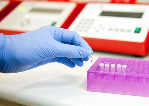 Simple genetic tests and protein analyses are commonly done with an electrophoretic mobility shift assay.