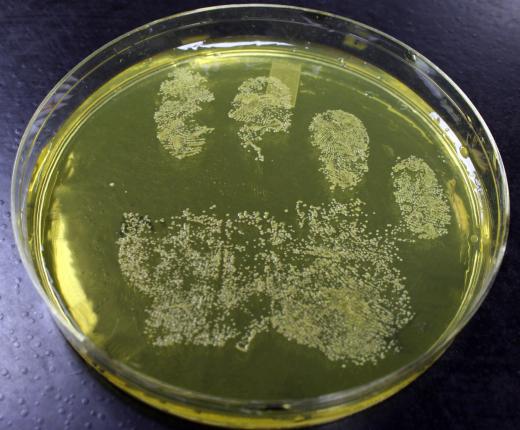 Bacteria are typically cultured inside of petri dishes.