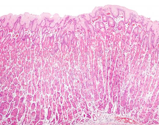 Selective permeability occurs in the cells lining the stomach.