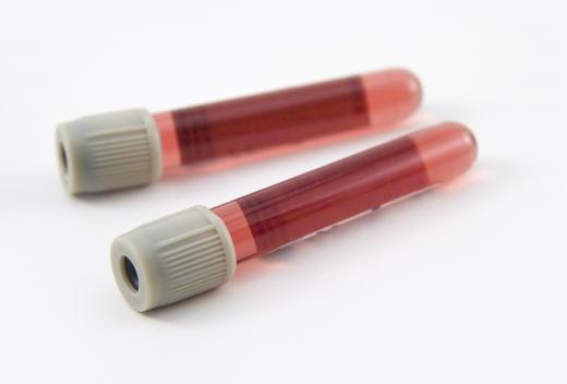 The concentration of bacteria or viruses in a blood sample can sometimes be determined using a test called a hemagglutination assay.