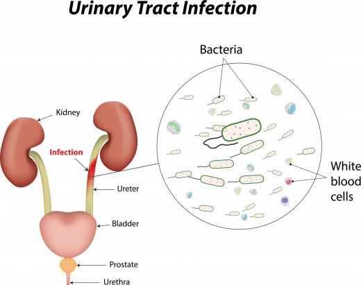 Escherichia coli can invade the urinary tract, causing a urinary tract infection.