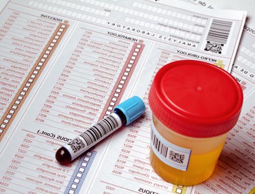 Blood and urine samples are collected and analyzed by a clinical pathologist.